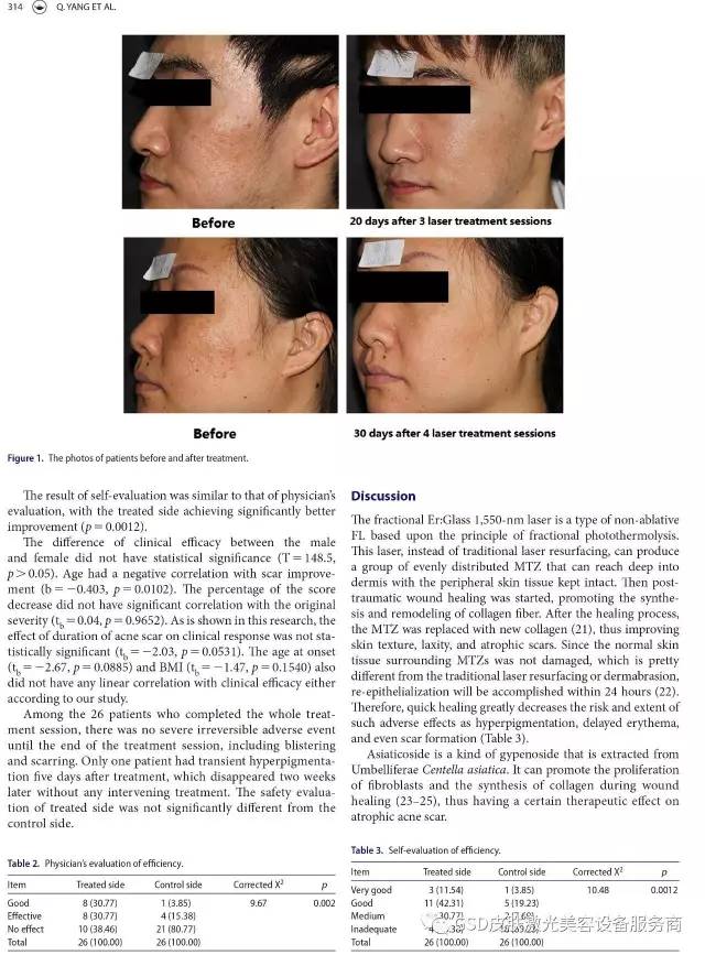 青春痘治疗排名_青春痘激光治疗(3)