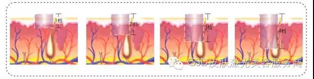 1512002201908814.jpg 23.jpg