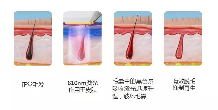 1564121293428693.jpg 4.jpg