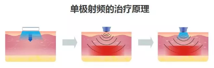 1609808249507063.png image.png